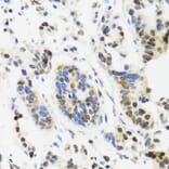 Immunohistochemistry - Anti-TOP1 Antibody (A7741) - Antibodies.com