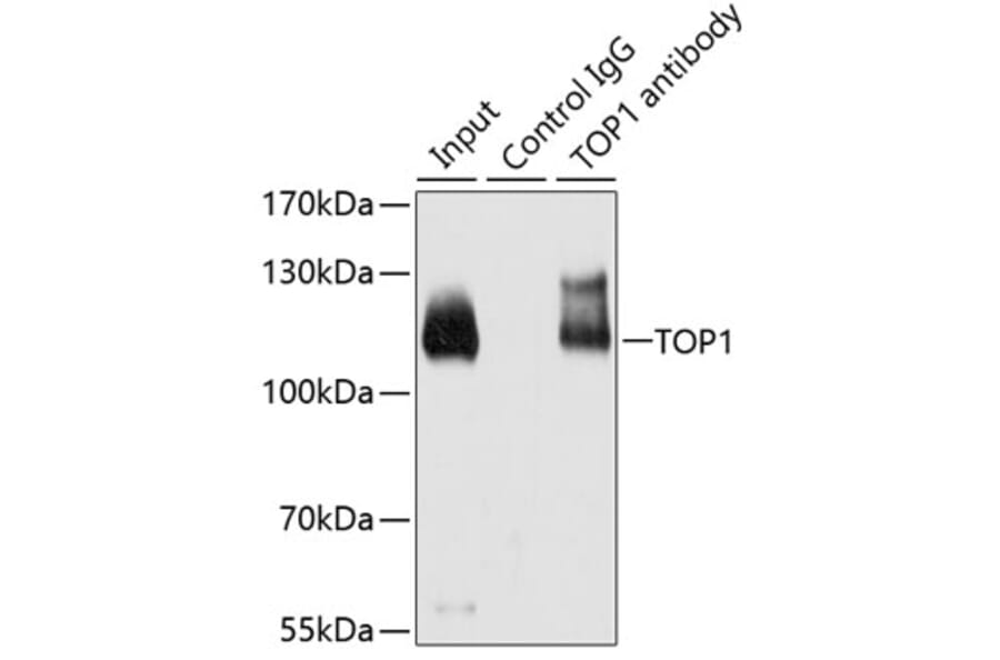Immunoprecipitation - Anti-TOP1 Antibody (A7741) - Antibodies.com