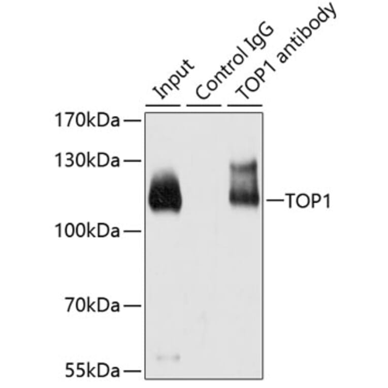 Immunoprecipitation - Anti-TOP1 Antibody (A7741) - Antibodies.com