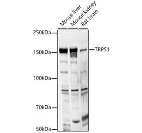 Western Blot - Anti-TRPS1 Antibody (A12162) - Antibodies.com