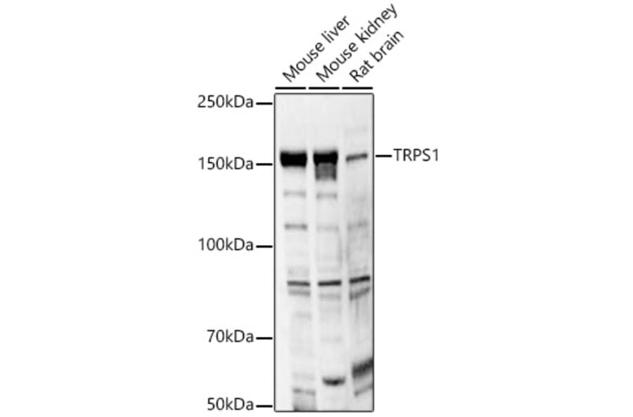 Western Blot - Anti-TRPS1 Antibody (A12162) - Antibodies.com