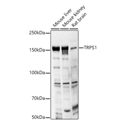 Western Blot - Anti-TRPS1 Antibody (A12162) - Antibodies.com