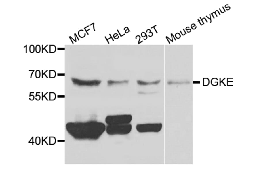Western Blot - Anti-DGKE Antibody (A7752) - Antibodies.com