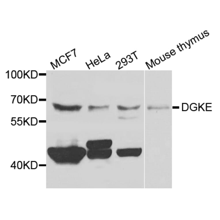 Western Blot - Anti-DGKE Antibody (A7752) - Antibodies.com