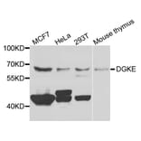 Western Blot - Anti-DGKE Antibody (A7752) - Antibodies.com