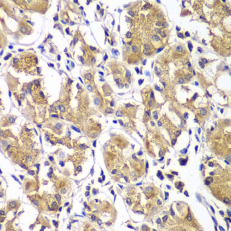 Immunohistochemistry - Anti-DGKE Antibody (A7752) - Antibodies.com