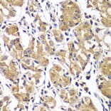 Immunohistochemistry - Anti-DGKE Antibody (A7752) - Antibodies.com