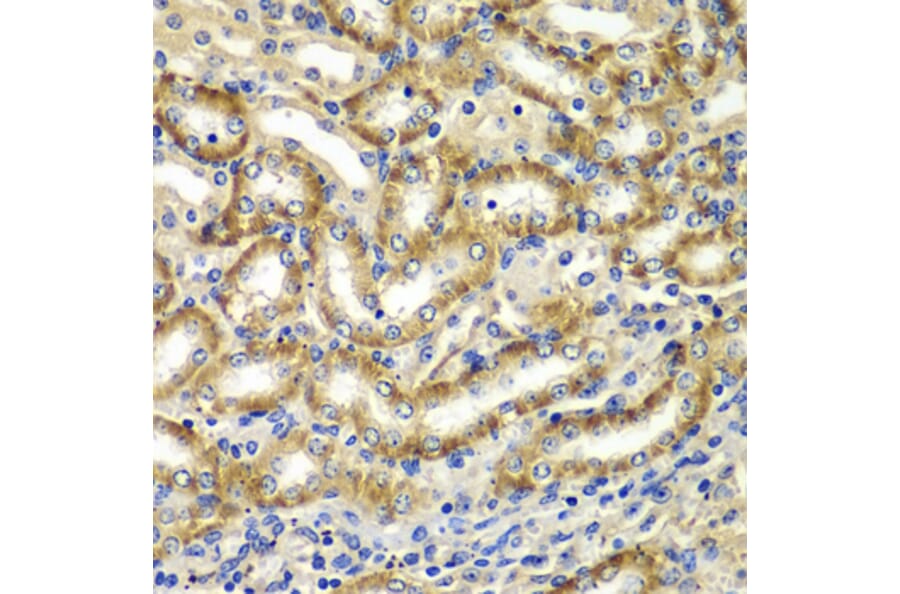 Immunohistochemistry - Anti-DGKE Antibody (A7752) - Antibodies.com