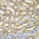 Immunohistochemistry - Anti-DGKE Antibody (A7752) - Antibodies.com