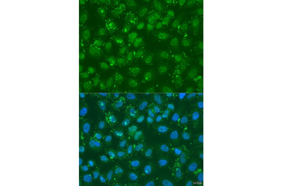 Immunofluorescence - Anti-DGKE Antibody (A7752) - Antibodies.com