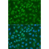 Immunofluorescence - Anti-DGKE Antibody (A7752) - Antibodies.com