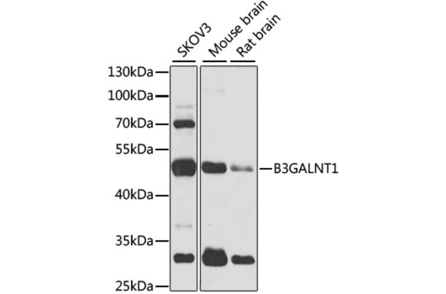 Western Blot - Anti-B3GALNT1 Antibody (A7755) - Antibodies.com