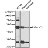 Western Blot - Anti-B3GALNT1 Antibody (A7755) - Antibodies.com