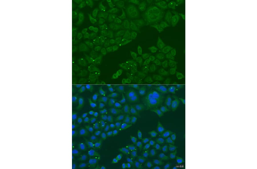 Immunofluorescence - Anti-B3GALNT1 Antibody (A7755) - Antibodies.com