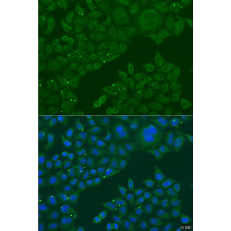 Immunofluorescence - Anti-B3GALNT1 Antibody (A7755) - Antibodies.com