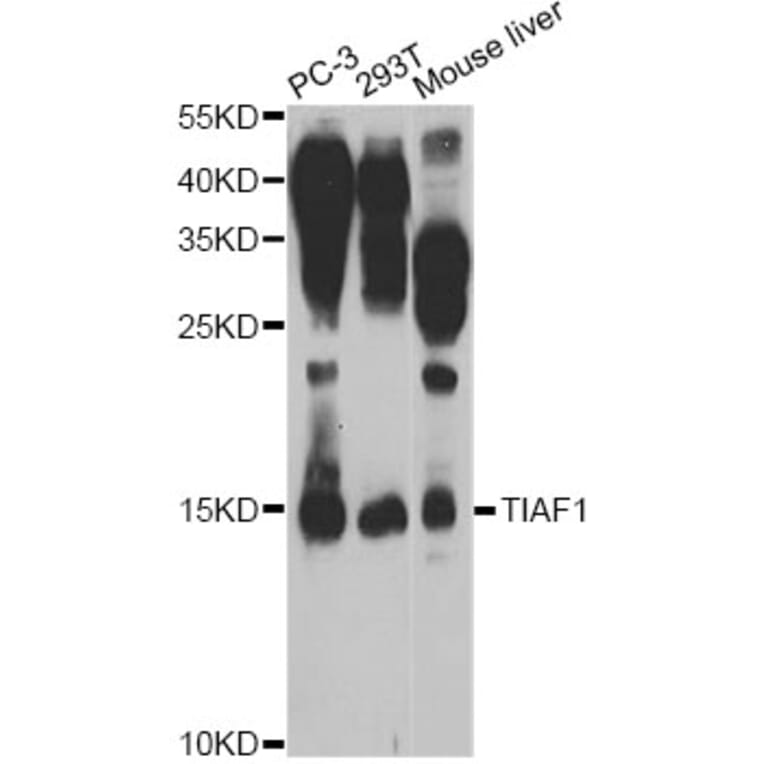 Western Blot - Anti-TIAF1 Antibody (A7762) - Antibodies.com