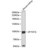 Western Blot - Anti-Endofin Antibody (A12166) - Antibodies.com