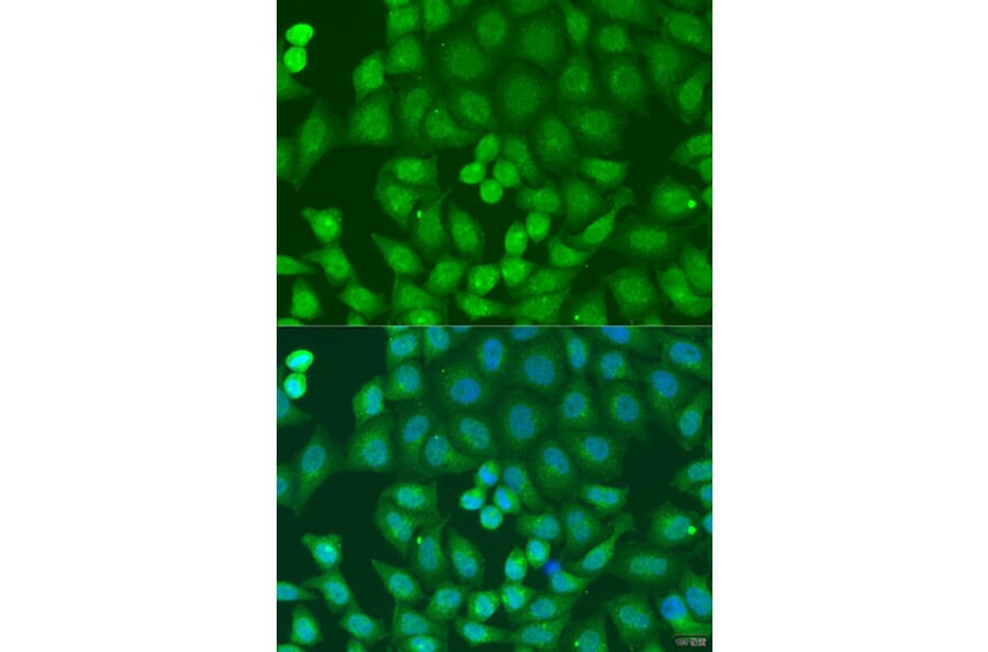 Immunofluorescence - Anti-Endofin Antibody (A12166) - Antibodies.com