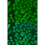 Immunofluorescence - Anti-Endofin Antibody (A12166) - Antibodies.com