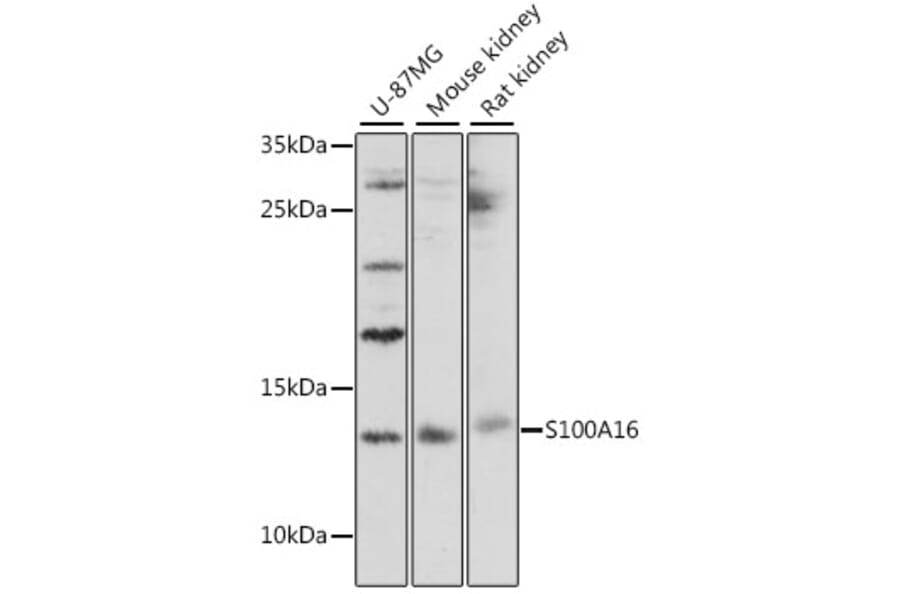 Western Blot - Anti-COQ7 Antibody (A12167) - Antibodies.com