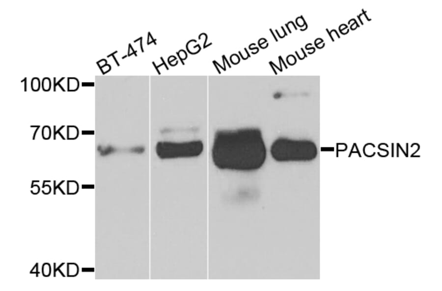Western Blot - Anti-PACSIN2 Antibody (A7781) - Antibodies.com