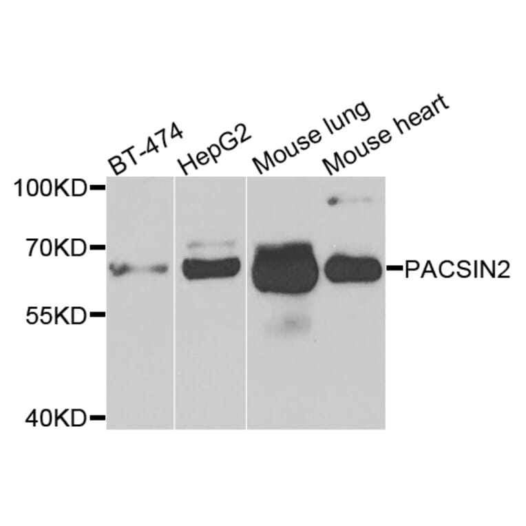 Western Blot - Anti-PACSIN2 Antibody (A7781) - Antibodies.com
