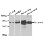 Western Blot - Anti-PACSIN2 Antibody (A7781) - Antibodies.com