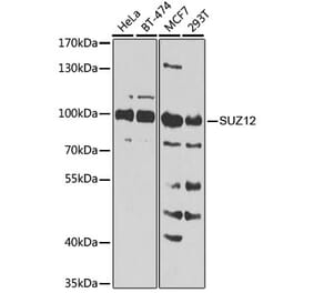 Western Blot - Anti-SUZ12 Antibody (A12169) - Antibodies.com