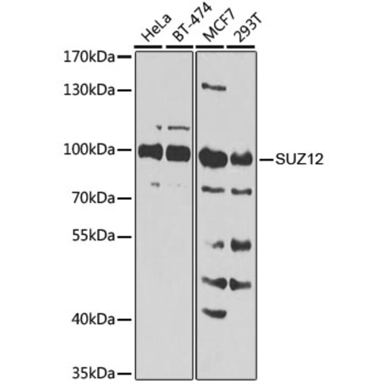 Western Blot - Anti-SUZ12 Antibody (A12169) - Antibodies.com