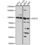 Western Blot - Anti-SUZ12 Antibody (A12169) - Antibodies.com