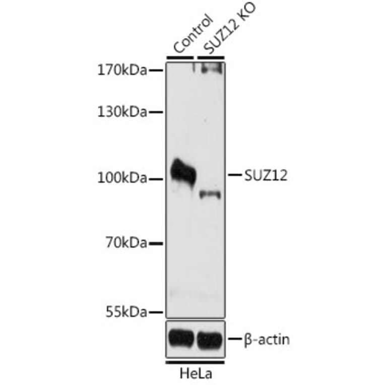 Western Blot - Anti-SUZ12 Antibody (A12169) - Antibodies.com