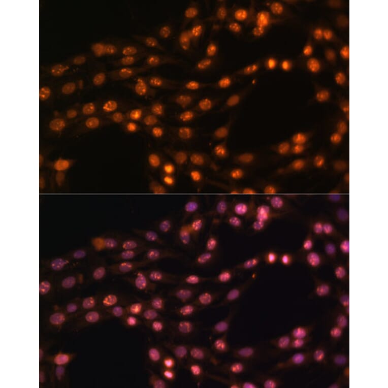 Immunofluorescence - Anti-SUZ12 Antibody (A12169) - Antibodies.com