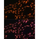 Immunofluorescence - Anti-SUZ12 Antibody (A12169) - Antibodies.com