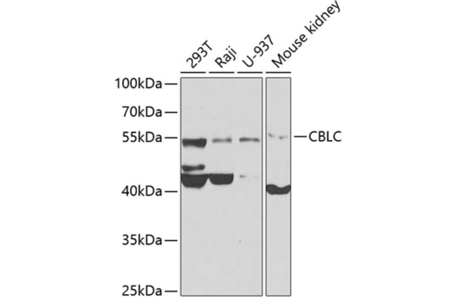 Western Blot - Anti-Cbl-c Antibody (A12170) - Antibodies.com
