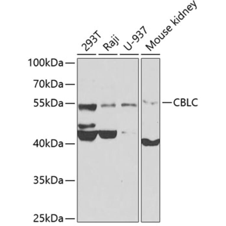 Western Blot - Anti-Cbl-c Antibody (A12170) - Antibodies.com