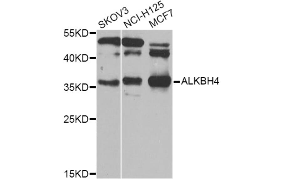 Western Blot - Anti-ALKBH4 Antibody (A7812) - Antibodies.com