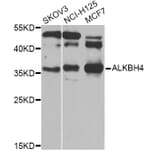 Western Blot - Anti-ALKBH4 Antibody (A7812) - Antibodies.com
