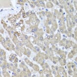 Immunohistochemistry - Anti-ALKBH4 Antibody (A7812) - Antibodies.com