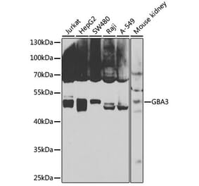 Western Blot - Anti-GBA3 Antibody (A12174) - Antibodies.com