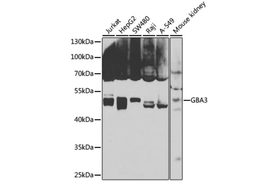 Western Blot - Anti-GBA3 Antibody (A12174) - Antibodies.com