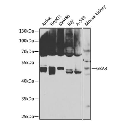 Western Blot - Anti-GBA3 Antibody (A12174) - Antibodies.com