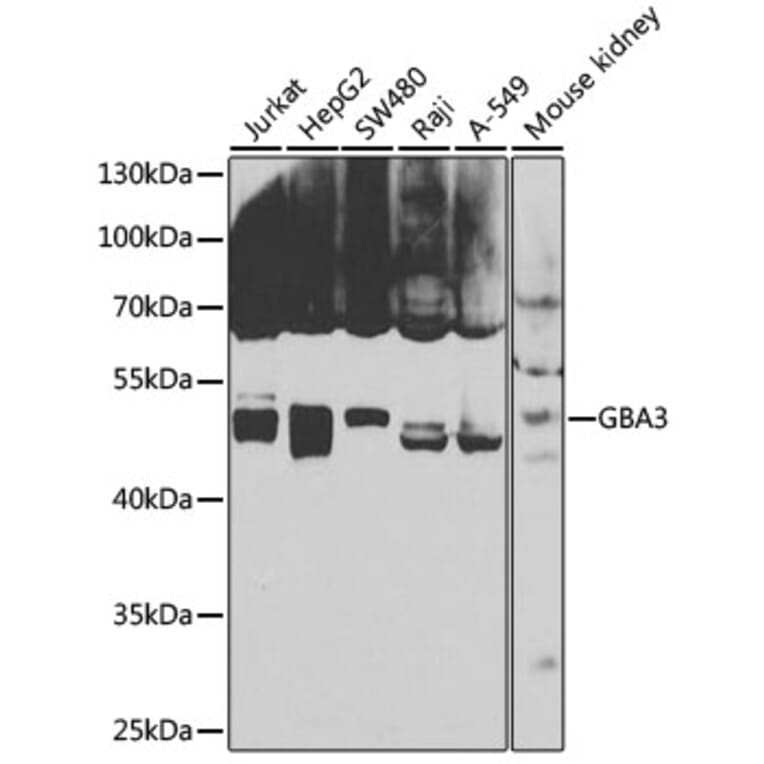 Western Blot - Anti-GBA3 Antibody (A12174) - Antibodies.com