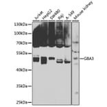 Western Blot - Anti-GBA3 Antibody (A12174) - Antibodies.com