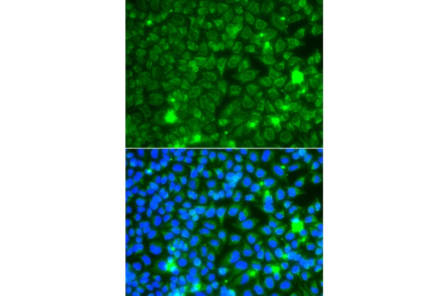 Immunofluorescence - Anti-GBA3 Antibody (A12174) - Antibodies.com