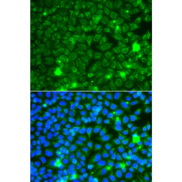 Immunofluorescence - Anti-GBA3 Antibody (A12174) - Antibodies.com