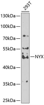 Western blot analysis of extracts of 293T cells, using Anti-NYX Antibody (A7830) at 1:1,000 dilution.
Secondary antibody: Goat Anti-Rabbit IgG (H+L) (HRP) (AS014) at 1:10,000 dilution.
Lysates / proteins: 25µg per lane.
Blocking buffer: 3% non-fat dry milk in TBST.
Detection: ECL Basic Kit (RM00020).
Exposure time: 90s.