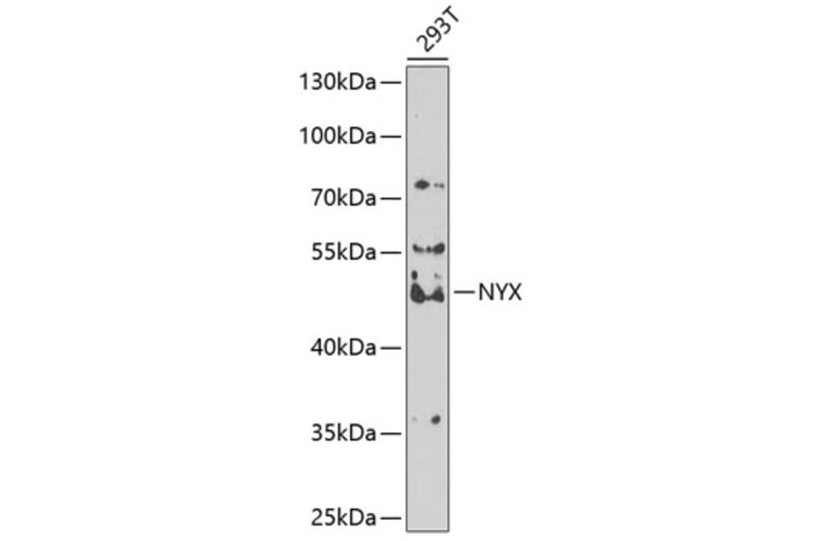 Western Blot - Anti-Nyctalopin Antibody (A12175) - Antibodies.com