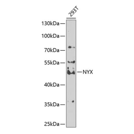 Western Blot - Anti-Nyctalopin Antibody (A12175) - Antibodies.com