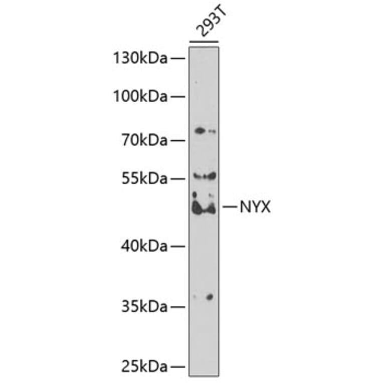 Western Blot - Anti-Nyctalopin Antibody (A12175) - Antibodies.com