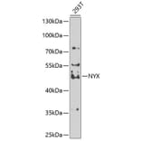 Western Blot - Anti-Nyctalopin Antibody (A12175) - Antibodies.com